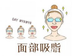 面部吸脂怎么樣？需要恢復(fù)多久才能好？