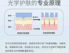 光子嫩膚性怎么樣？