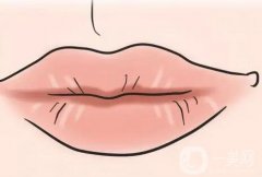 如何防止嘴唇出現(xiàn)皺紋？嘴唇上有皺紋是什么原因？