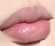 紋唇可能引發(fā)哪些危害？紋唇線有什么危害？