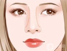 什么因素與的恢復(fù)時(shí)間有關(guān)？