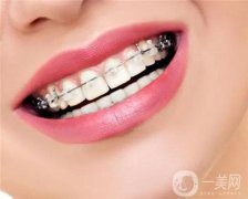 牙齒矯正有年齡限制嗎?會(huì)松動(dòng)嗎?