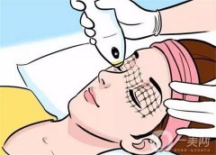 熱瑪吉有什么優(yōu)勢？會(huì)導(dǎo)致皮膚損傷嗎？