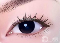 不適合開眼角的人群？不適合開眼角的人群有哪些？