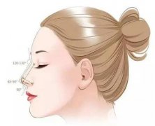 矯正鷹鉤鼻嗎?哪里矯正鷹鉤鼻比較好?