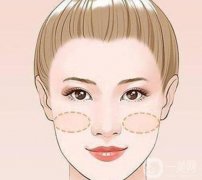 蘋果肌凹陷怎么處理？蘋果肌在哪里？