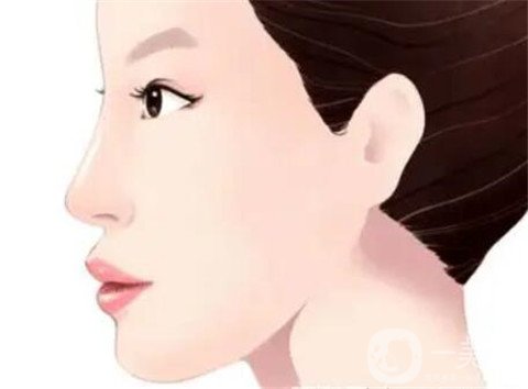 湖南省人民醫(yī)院整形美容科隆鼻*果如何？看價格表及案例實述