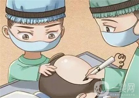 西南醫(yī)院美容整形科*新價(jià)格表公布,附植發(fā)案例*果