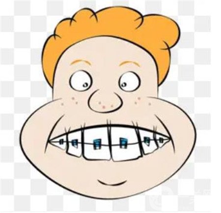 貴陽(yáng)口腔醫(yī)院整牙貴嗎?正畸價(jià)格表及案例一覽