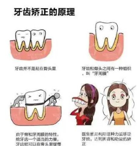 貴陽(yáng)口腔醫(yī)院整牙貴嗎?正畸價(jià)格表及案例一覽