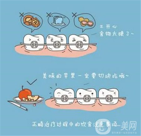 貴陽(yáng)口腔醫(yī)院整牙貴嗎?正畸價(jià)格表及案例一覽