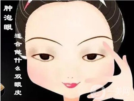 北京處靳小雷怎么預(yù)約？雙眼皮修復(fù)案例及整形價(jià)格表