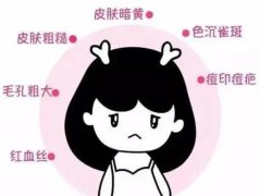 用深藍(lán)射頻去除黑眼圈嗎？有嗎？