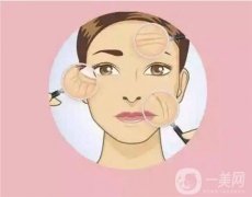 射頻緊膚的原理是什么？優(yōu)勢是什么？