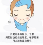 抽脂減肥后的疼痛怎么緩解？面部可以抽脂嗎？