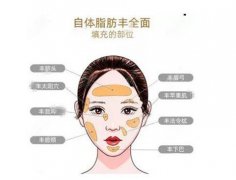自體脂肪可以填充哪些部位?可以維持多久?