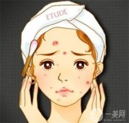 有哪些類型的？做激光會(huì)損傷皮膚嗎？