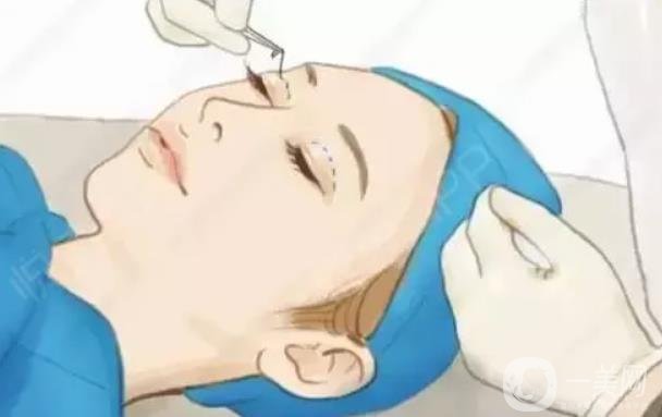 眼部整形的下眼下至術(shù)前準(zhǔn)備工作主要有哪些？