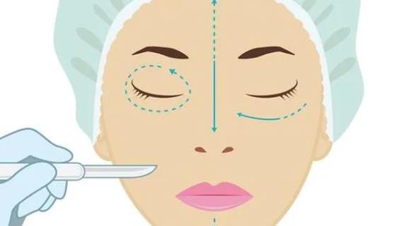 成都雙眼皮價(jià)格