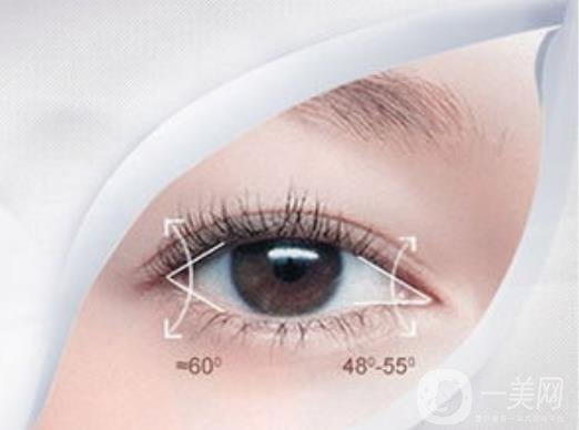 北京,開眼角,多少錢