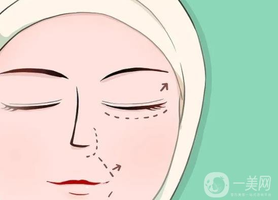 北京,開眼角,多少錢