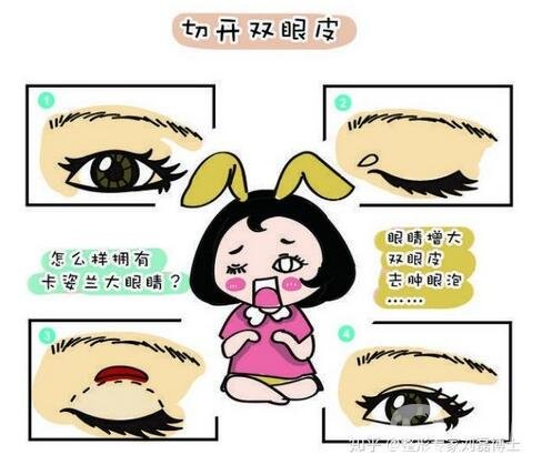 玻尿酸豐臥蠶幾天消腫？