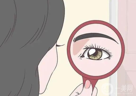 愛思特張姣姣,雙眼皮