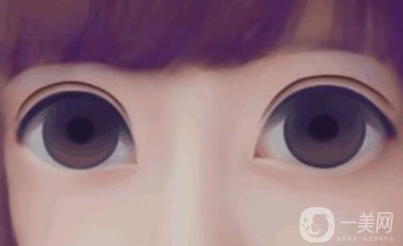 割雙眼皮術(shù)后恢復(fù)周期