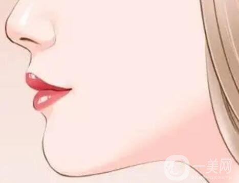 雙下巴抽脂多久恢復(fù) 雙下巴吸脂幾天恢復(fù)