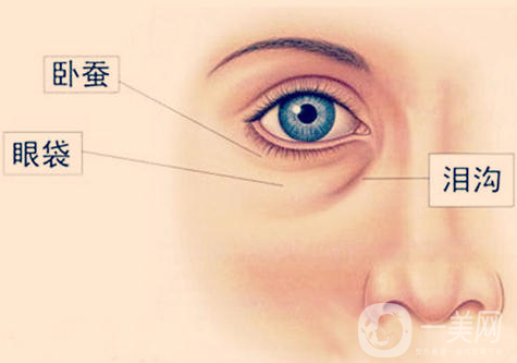 玻尿酸豐臥蠶會擴(kuò)散嗎 注意事項有哪些