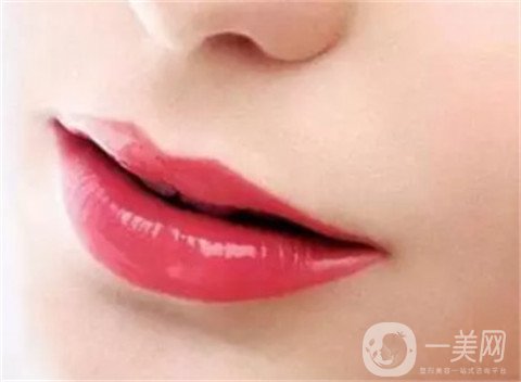 豐唇需要多少錢呢？