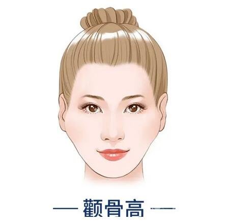 顴骨內(nèi)推注意事項(xiàng)詳情介紹