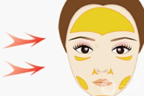 自體脂肪填充的價格是怎么計費的?