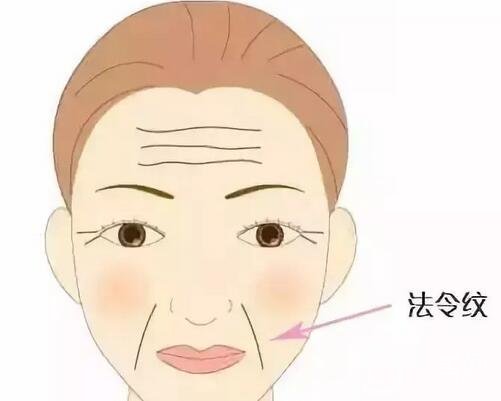 法令紋怎么去除呢？