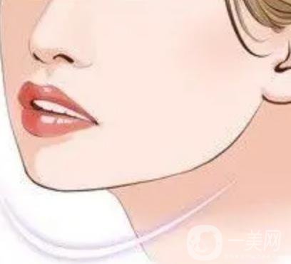 廣東做顴骨手術(shù)多少錢