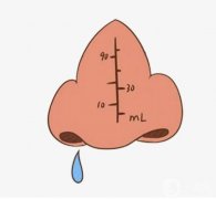 長春墊鼻子需要多少錢?2023年三點(diǎn)分析