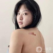 對(duì)于我們這種身上有疤的人來(lái)說(shuō)，每一塊地方都是一個(gè)特別痛苦的回憶