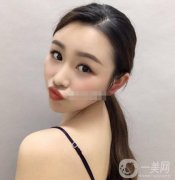 除皺:面診的時(shí)候，醫(yī)生也是的專業(yè)，說出了本人的問題，結(jié)合問題做出了方案