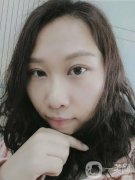 雙眼皮恢復(fù)這段時(shí)間我也收到了醫(yī)生很大的關(guān)懷，手術(shù)做的很快，大概不到兩個(gè)