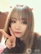 本來還是有一些單眼皮的，就是眼睛有點腫，看起來真的是特別的不好看