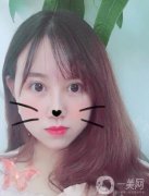 整完雙眼皮已經(jīng)一個多禮拜了，前幾天的眼睛真的是特別的腫，現(xiàn)在真的好了許