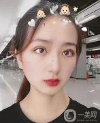 眼綜合手術(shù)已經(jīng)過去四個月的時間了，自從我做完手術(shù)之后，我?guī)ьI(lǐng)了我身邊的