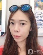 做完熱瑪吉項目已經(jīng)兩個月的時間了，近我還給醫(yī)生發(fā)去了我現(xiàn)在的照片