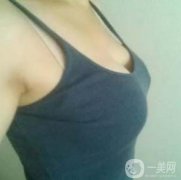 在隆胸拆線之后幾乎我就恢復了正常的生活了，也可以正常的洗澡了，就是需要