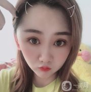 做完拉皮手術(shù)已經(jīng)有兩個月的時間了，大家看一下，我是不是有了大的變化