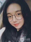 建議本人做一個玻尿酸除皺，當時就下定決心做這個項目了