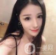 玻尿酸注射后的第一天，很好看，我是那種追求小V的女生