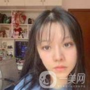 今天的雙眼皮還是有點腫，錄了下來