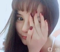 雖然才9天，鼻子沒有太大的腫脹，但是還是很美