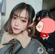 醫(yī)生給我設計的這個下巴實在是太了